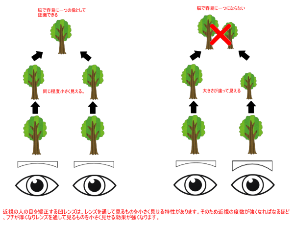 不同視の人の見え方（メガネ）